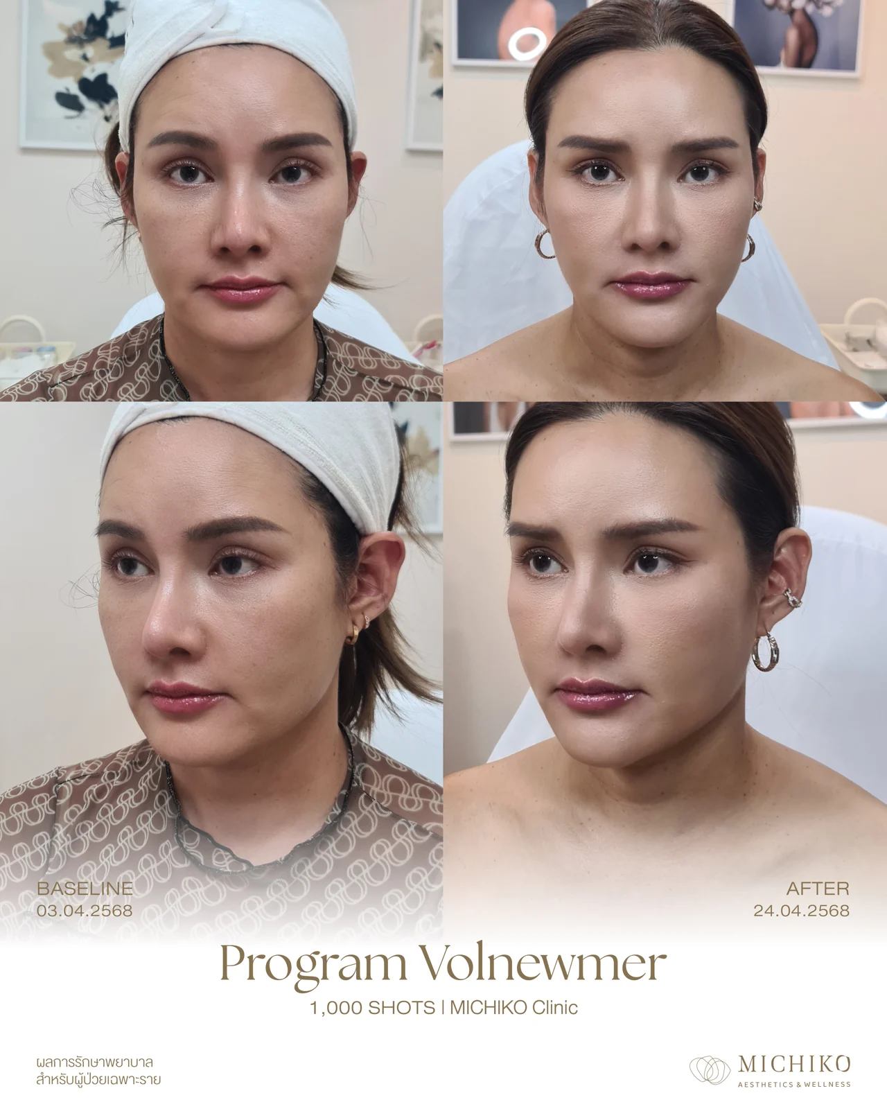MICHIKO Volnewmer case