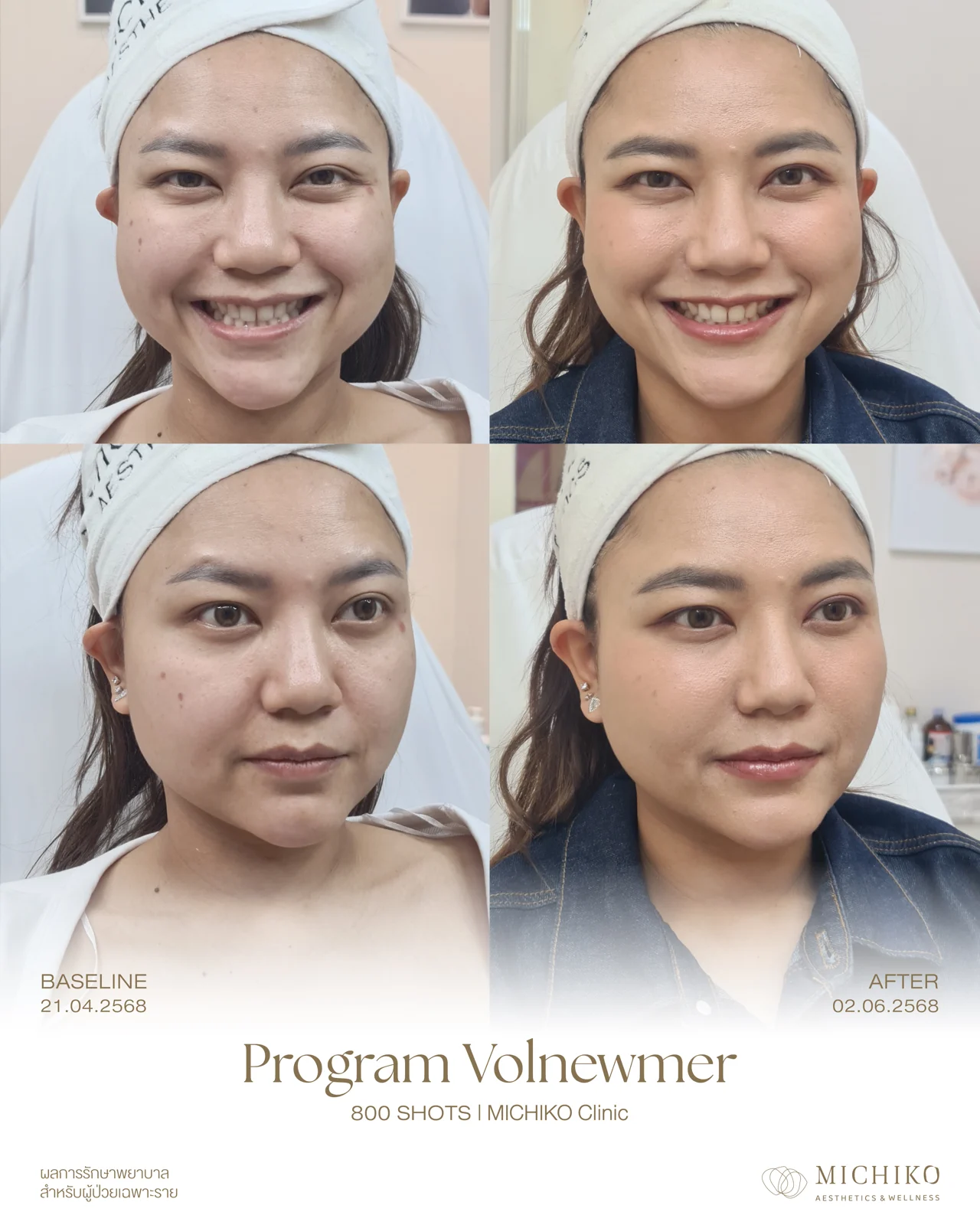 MICHIKO consultation or treatment photograph