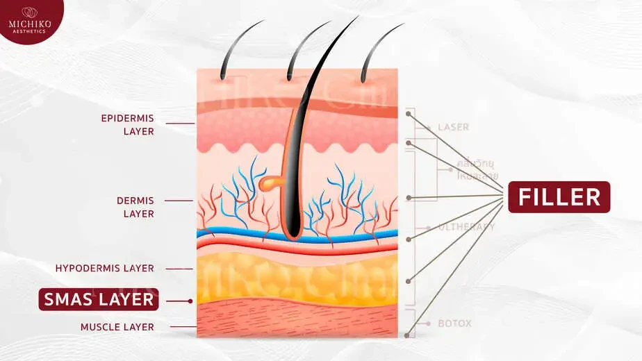 The layers involved in facial support