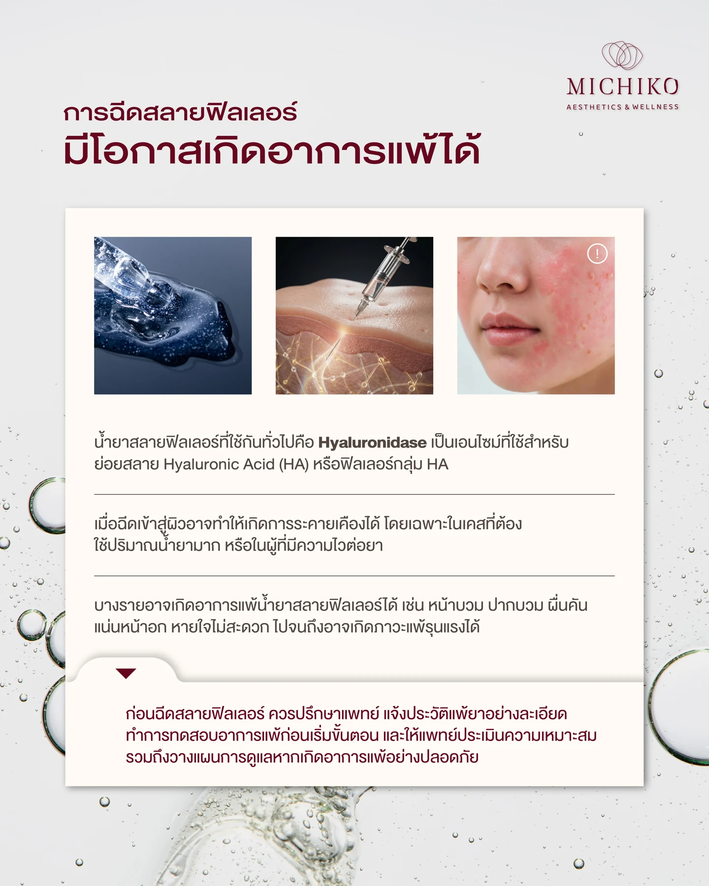 ความเสี่ยงการแพ้