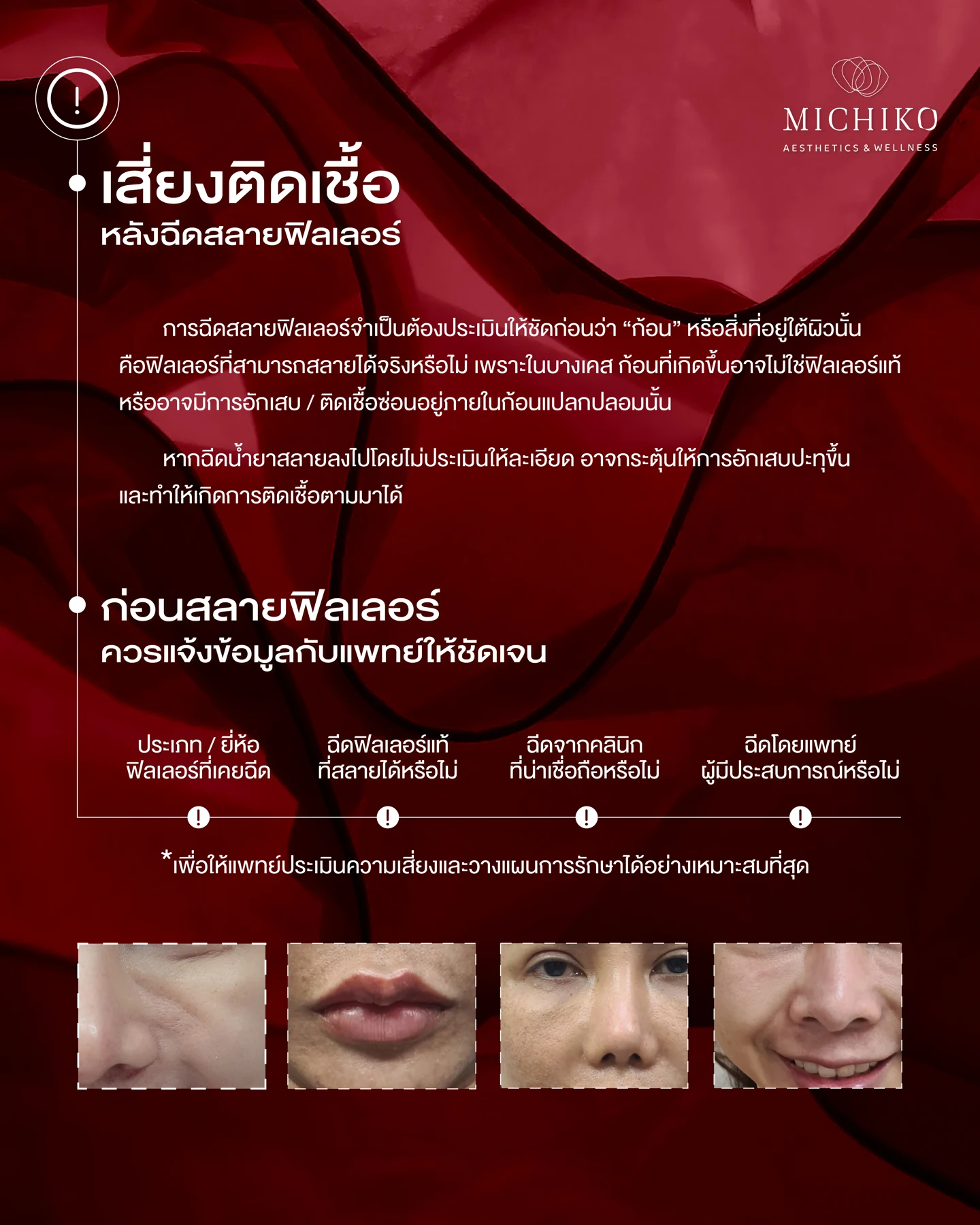การประเมินและความเสี่ยงติดเชื้อก่อนสลายฟิลเลอร์
