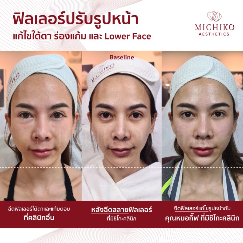 ลดความเต็มใต้ตา ก่อนวางแผนปรับสมดุลใหม่