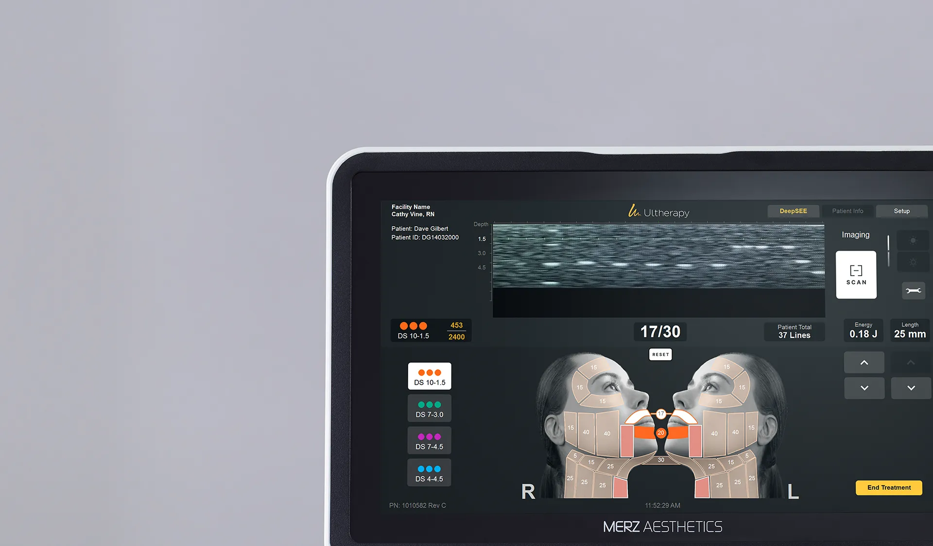 Ultherapy PRIME device reference