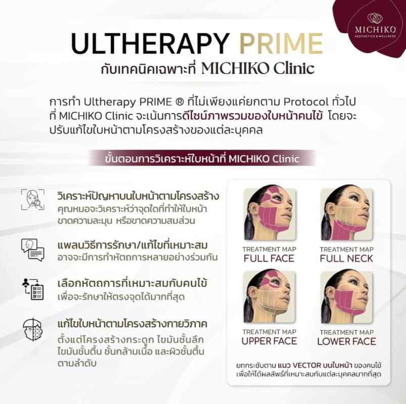 ภาพข้อมูล Ultherapy PRIME ต้นฉบับจาก MICHIKO