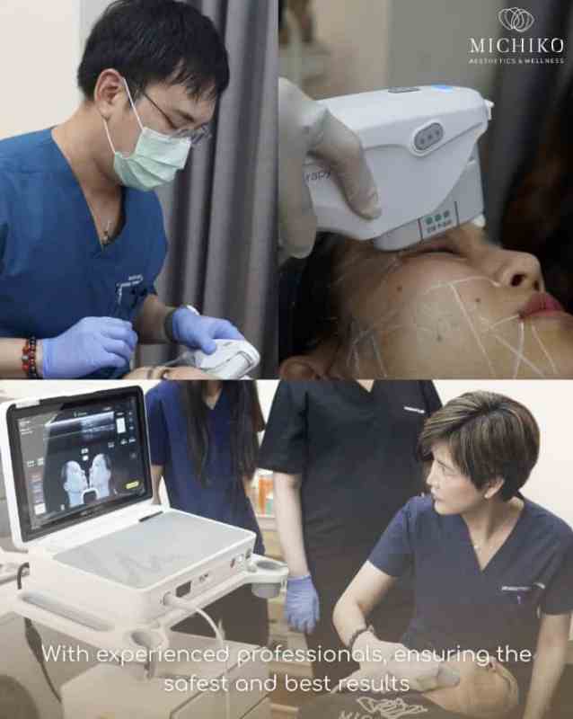 ภาพข้อมูล Ultherapy PRIME ต้นฉบับจาก MICHIKO