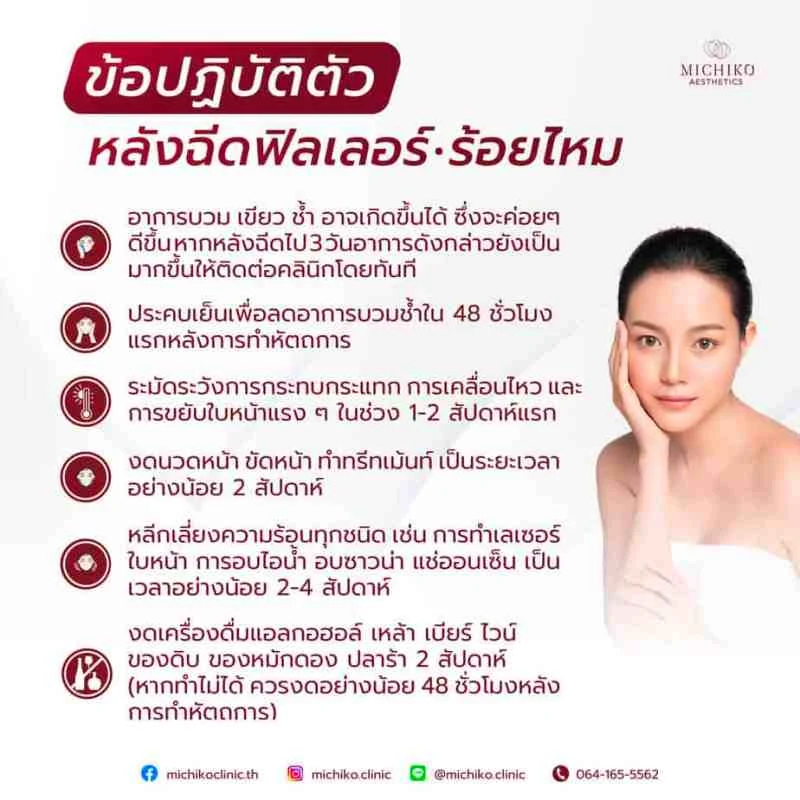ฟิลเลอร์คาง