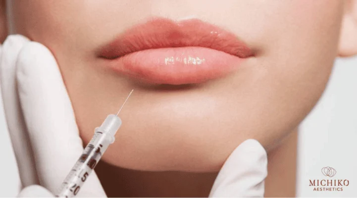 Lip filler injection illustration from the original MICHIKO treatment guide