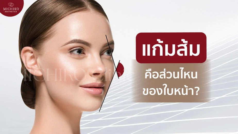ฟิลเลอร์แก้ไข Mid-Face