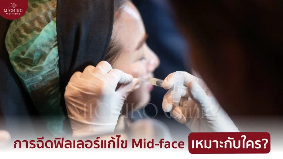 ฟิลเลอร์แก้ไข Mid-Face