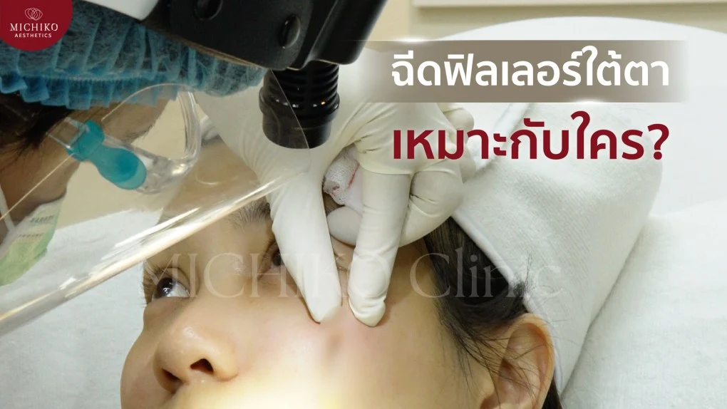ฟิลเลอร์ใต้ตา เหมาะกับ
