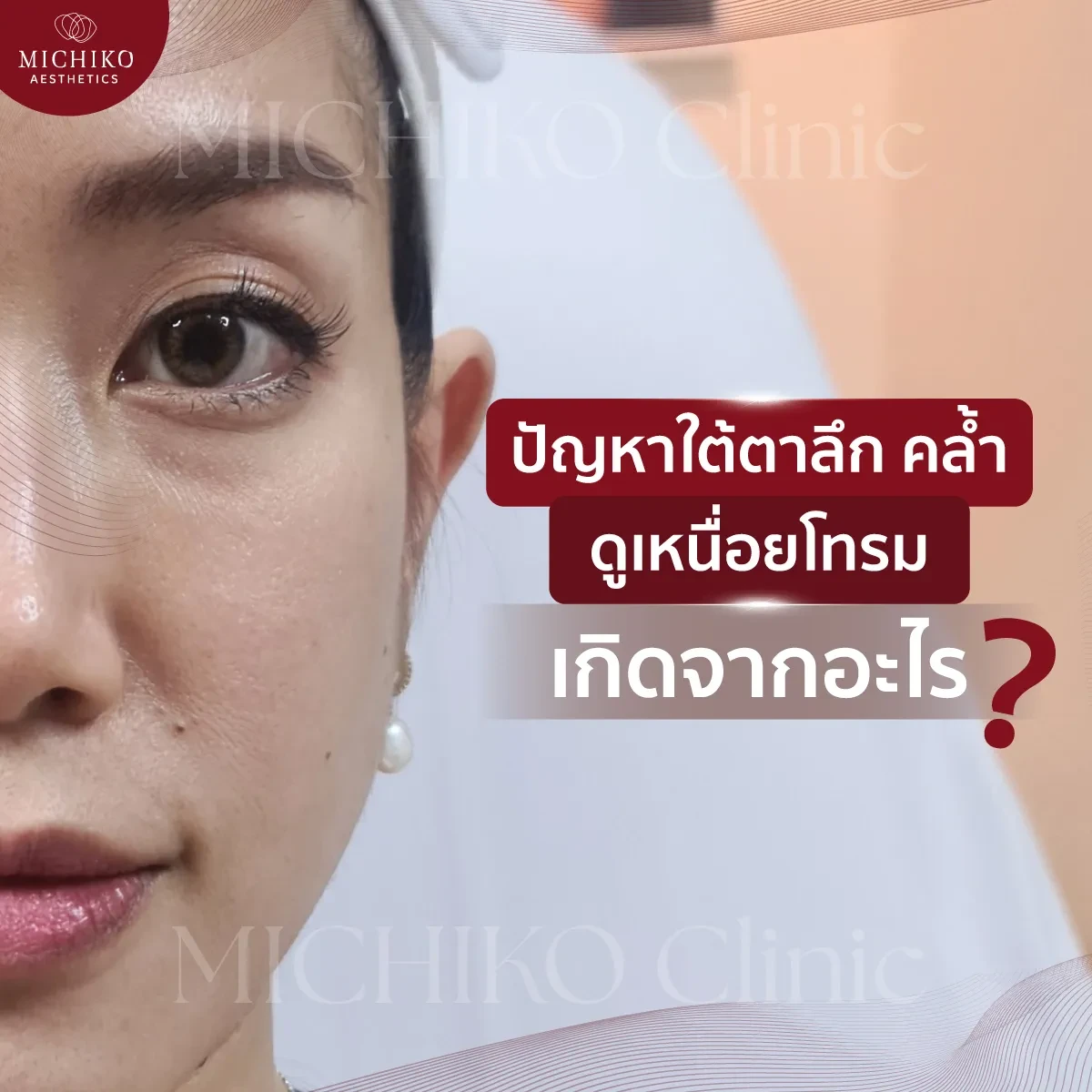 ปัญหาใต้ตาลึก คล้ำ ดูเหนื่อยโทรม เกิดจากอะไร