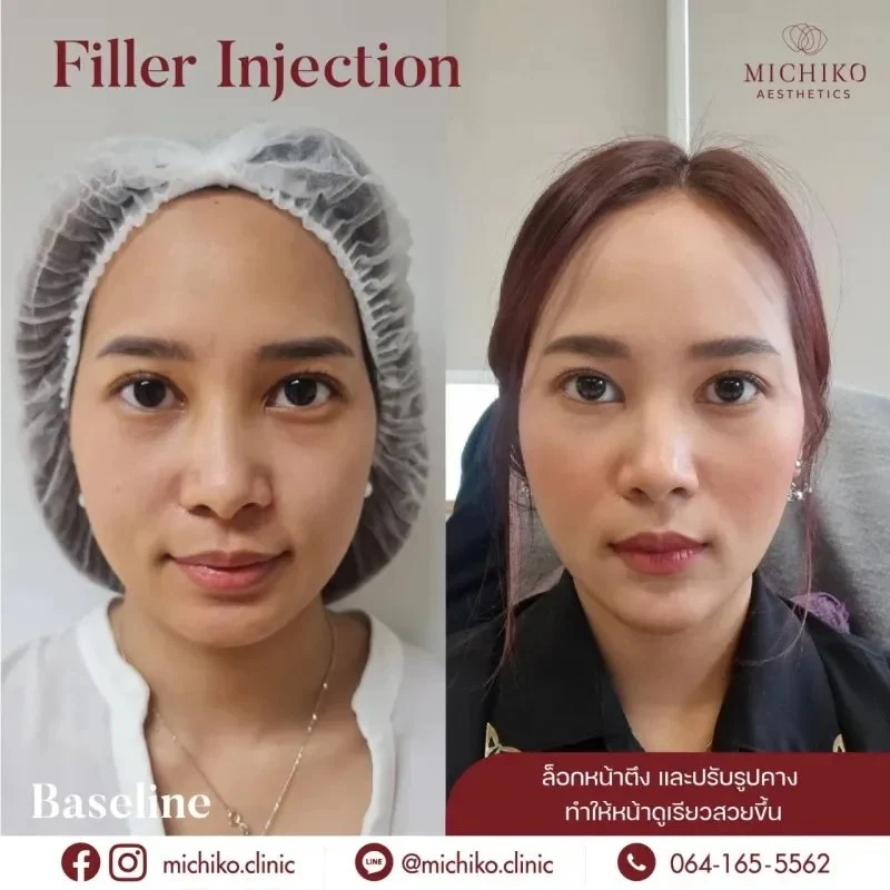 MICHIKO filler case, original comparison image