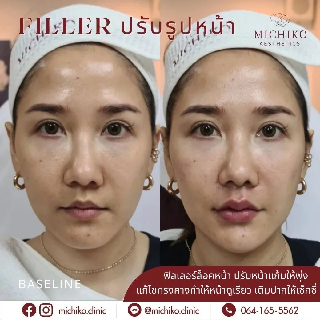 MICHIKO filler case, original comparison image